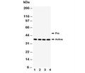 Western blot testing of Caspase-12 antibody; Lane 1: PANC; 2: SMMC-7721; 3: A549; 4: HeLa. Predicted molecular weight ~50/36~42kDa (pro/active).