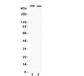 Western blot testing of Huntingtin antibody and Lane 1: human HeLa cell lysate and 2: human U-87 MG cell lysate. Predicted molecular weight: ~350 kDa.