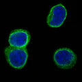 Western blot testing of human Jurkat cell lysate with CD3D antibody. Predicted molecular weight ~19 kDa.