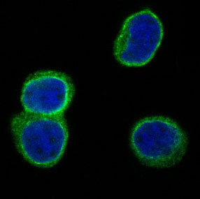 Western blot testing of human Jurkat cell lysate with CD3D antibody. Predicted molecular weight ~19 kDa.