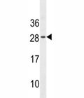 EPO antibody western blot analysis in WiDr lysate. Predicted molecular weight: 18-34 kDa depending on glycosylation level.