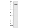 Western blot testing of human Jurkat cell lysate with ITGA4 antibody. Predicted molecular weight ~115 kDa, routinely observed at ~150 kDa.