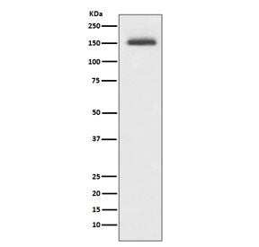 Western blot testing of human Jurkat cell lysate with ITGA4 antibody. Predicted molecular weight ~115 kDa, routinely observed at ~150 kDa.