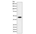 Western blot testing of human HEK293 cell lysate wit ADSS2 antibody. Predicted molecular weight ~50 KDa.