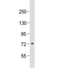 Western blot testing of human Jurkat cell lysate with CTCFL antibody at 1:2000. Predicted molecular weight: 76 kDa.
