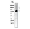 Western blot testing of human ovary tissue lysate using recombinant CAD antibody (clone CALD1/7024R). Predicted molecular weight ~93 kDa, can be observed at 70-80 kDa (non muscle tissue) and 120-150 kDa (smooth muscle).