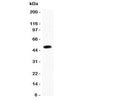 Western blot testing of CCL7 antibody and recombinant mouse protein (0.5ng)