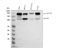 Western blot analysis of IGF1R using anti-IGF1R antibody. Lane 1: human Hela whole cell lysates, Lane 2: human MCF-7 whole cell lysates, Lane 3: human SH-SY5Y whole cell lysates, Lane 4: human whole cell lysates. After electrophoresis, proteins were transferred to a nitrocellulose membrane at 150 mA for 50-90 min. Blocked the membrane with 5% non-fat milk/TBS for 1.5 hour at RT.