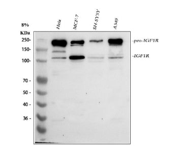 Western blot analysis of IGF1R using anti-IGF1R antibody. Lane 1: human Hela whole cell lysates, Lane 2: human MCF-7 whole cell lysates, Lane 3: human SH-SY5Y whole cell lysates, Lane 4: human whole cell lysates. After electrophoresis, proteins were transferred to a nitrocellulose membrane at 150 mA for 50-90 min. Blocked the membrane with 5% non-fat milk/TBS for 1.5 hour at RT.