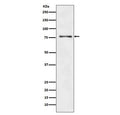 Western blot testing of human HepG2 cell lysate with ATG7 antibody. Predicted molecular weight: 70-80 kDa.