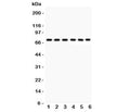 Western blot testing of Kininogen 1 antibody and human samples 1: U87; 2: MCF-7; 3: SKOV; 4: SW620; 5: COLO320; 6: placenta lysate. Predicted/observed molecular weight ~72kDa (HMWK).