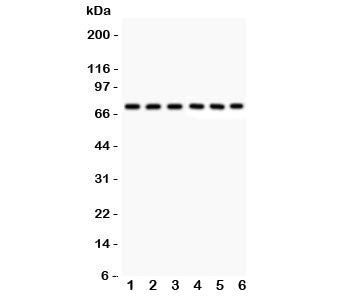 Western blot testing of Kininogen 1 antibody and human samples 1: U87; 2: MCF-7; 3: SKOV; 4: SW620; 5: COLO320; 6: placenta lysate. Predicted/observed molecular weight ~72kDa (HMWK).