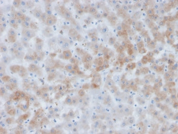 IHC staining of FFPE human liver tissue with AACT antibody (clone SERPINA3/4184). HIER: boil tissue sections in pH 9 10mM Tris with 1mM EDTA for 20 min and allow to cool before testing.