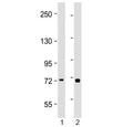 Western blot testing of human 1) placenta and 2) Jurkat lysate with TAP2 antibody at 1:2000. Predicted molecular weight ~76 kDa.