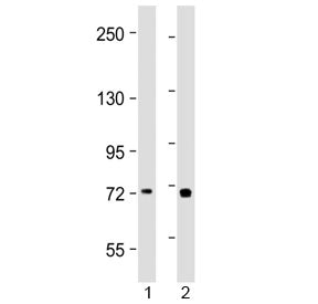Western blot testing of human 1) placenta and 2) Jurkat lysate with TAP2 antibody at 1:2000. Predicted molecular weight ~76 kDa.
