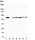 Western blot testing of MAPK8/9 antibody and Lane 1: rat brain; 2: rat thymus and human 3: MCF-7; 4: HeLa; 5: Jurkat; 6: MM231; 7: CEM cell lysate.