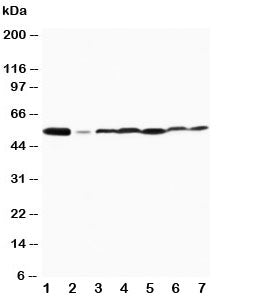 Western blot testing of MAPK8/9 antibody and Lane 1: rat brain; 2: rat thymus and human 3: MCF-7; 4: HeLa; 5: Jurkat; 6: MM231; 7: CEM cell lysate.