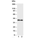 Western blot testing of MTCO1 antibody and Lane 1: rat heart; 2: mouse heart tissue lysate. Predicted molecular weight ~57 kDa, also observed at ~40 kDa (ref. 1).