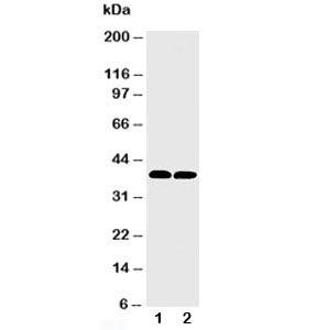 Western blot testing of MTCO1 antibody and Lane 1: rat heart; 2: mouse heart tissue lysate. Predicted molecular weight ~57 kDa, also observed at ~40 kDa (ref. 1).