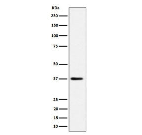 Western blot testing of human HepG2 cell lysate with MRPS31 antibody. Predicted molecular weight ~45 kDa, commonly observed at ~38 kDa.
