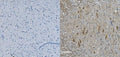 IHC staining of FFPE mouse spinal cord with Neurofilament heavy antibody (right) and negative control (left). HIER: boil tissue sections in pH8 EDTA for 20 min and allow to cool before testing.