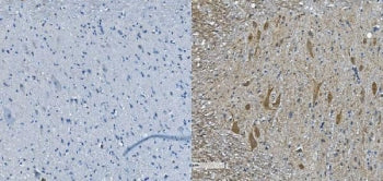 IHC staining of FFPE mouse spinal cord with Neurofilament heavy antibody (right) and negative control (left). HIER: boil tissue sections in pH8 EDTA for 20 min and allow to cool before testing.