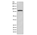 Western blot testing of human HeLa cell lysate with Glycogen synthase antibody. Predicted molecular weight ~84 kDa.