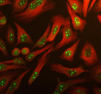 Immunofluorescent staining of using anti-ARL3 antibody (green) and anti-Beta Tubulin antibody (red). ARL3 was detected in an immunocytochemical section of human HeLa cells. Enzyme antigen retrieval was performed using IHC enzyme antigen retrieval reagent for 15 mins. The cells were blocked with 10% goat serum. And then incubated with 5 ug/ml rabbit anti-ARL3 antibody and mouse anti-Beta Tubulin antibody overnight at 4oC.