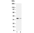 Western blot testing of Arginase 1 antibody and Lane 1: rat liver ; 2: rat kidney lysate. Predicted molecular weight ~35 kDa.