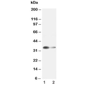 Western blot testing of Arginase 1 antibody and Lane 1: rat liver ; 2: rat kidney lysate. Predicted molecular weight ~35 kDa.