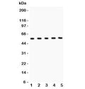 Western blot testing of MMP3 antibody and Lane 1: human placenta; 2: U20S; 3: HeLa; 4: PANC; 5: COLO320. Predicted molecular weight ~54 kDa.