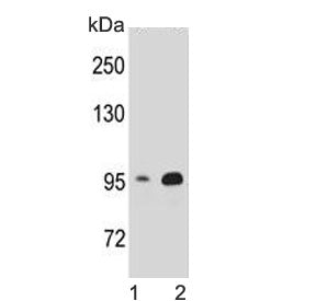 Western blot testing of human 1) HEK293 and 2) T-47D cell lysate with Catenin Beta antibody. Predicted molecular weight ~85 kDa, but routinely observed at 90-95 kDa.