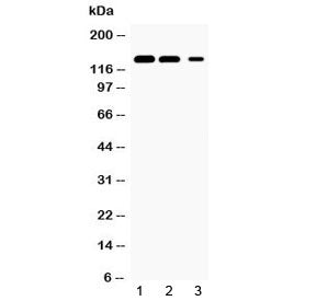 Western blot testing of 1) rat kidney, 2) mouse kidney and 3) human HeLa lysate with JAK1 antibody at 0.5ug/ml. Predicted molecular weight ~133 kDa.