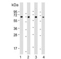 Western blot testing of 1) human SH-SY5Y, 2) human Jurkat, 3) mouse Neuro-2a and 4) mouse C2C12 cell lysate with COL8A2 antibody. Predicted molecular weight ~67 kDa.