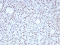 IHC staining of FFPE human parathyroid tissue with Forkhead box protein L2 antibody (clone FOXL2/8362R). HIER: boil tissue sections in pH 9 10mM Tris with 1mM EDTA for 20 min and allow to cool before testing.