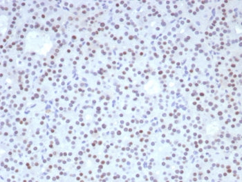 IHC staining of FFPE human parathyroid tissue with Forkhead box protein L2 antibody (clone FOXL2/8362R). HIER: boil tissue sections in pH 9 10mM Tris with 1mM EDTA for 20 min and allow to cool before testing.