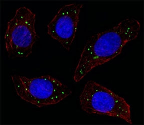Fluorescent image of U251 cell stained with MERTK antibody at 1:25. MERTK immunoreactivity is localized to vesicles.