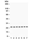 Western blot testing of rat 1) brain, 2) thymus, 3) testis, 4) mouse thymus, 5) mouse liver, 6) human HeLa and 7) human MCF7 lysate with RALA antibody. Expected/observed molecular weight ~24 kDa.