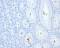 IHC staining of FFPE Helicobacter pylori-infected human stomach tissue with H pylori antibody (clone HPYL/7228). HIER: boil tissue sections in pH 9 10mM Tris with 1mM EDTA for 20 min and allow to cool before testing.