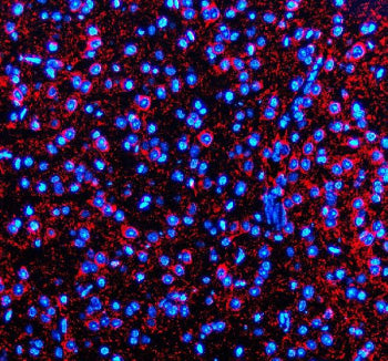 Immunofluorescent staining of Synaptotagmin-10/SYT10 using anti-SYT10 antibody (red). Synaptotagmin-10/SYT10 was detected in a paraffin-embedded section of mouse brain tissue. Heat mediated antigen retrieval was performed in EDTA buffer (pH 8.0, epitope retrieval solution). The tissue section was blocked with 10% goat serum. The tissue section was then incubated with 5 ug/ml rabbit anti-SYT10 antibody overnight at 4oC.