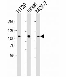 Western blot analysis of lysate from HT29, Jurkat, MCF-7 cell line (left to right) using TPX2 antibody
