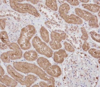 IHC testing of FFPE human kidney tissue with RPS18 antibody. HIER: steam section in pH9 EDTA for 20 min and allow to cool prior to staining.