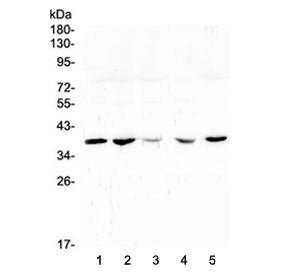 Western blot testing of human 1) placenta, 2) U-2 OS, 3) A431, 4) HeLa and 5) A549 lysate with uPAR antibody at 0.5ug/ml. Expected molecular weight: 37-60 kDa, depending on glycosylation level.