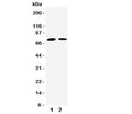Western blot testing of Transglutaminase 2 antibody and Lane 1: Jurkat; 2: HeLa cell lysate. Predicted/observed molecular weight: ~ 78kDa.