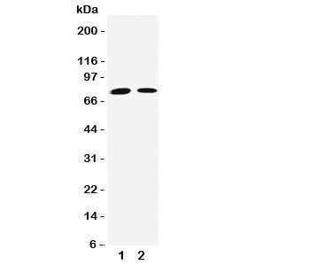 Western blot testing of Transglutaminase 2 antibody and Lane 1: Jurkat; 2: HeLa cell lysate. Predicted/observed molecular weight: ~ 78kDa.