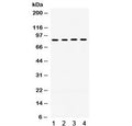 Western blot testing of 1) rat liver, 2) human placenta, 3) human HepG2 and 4) mouse HEPA1-6 lysate with POR antibody. Predicted molecular weight: ~77 kDa, observed here at ~85 kDa.