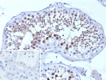 IHC staining of FFPE human testis tissue with SMN1 antibody (clone SMN1/1596). Inset: PBS used in place of primary Ab (secondary Ab negative control). HIER: boil tissue sections in pH 9 10mM Tris with 1mM EDTA for 20 min and allow to cool before testing.
