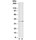 Western blot testing of K562 [A] and NIH3T3 [B] lysates with Annexin A1 antibody at 1ug/ml. Predicted molecular weight ~38kDa.