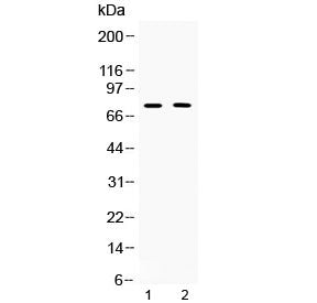 Western blot testing of 1) rat thymus and 2) human COLO320 lysate with TRF2 antibody at 0.5ug/ml. Predicted molecular weight ~75 kDa.