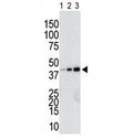 Anti-GST antibody used in western blot to detect a GST-tagged recombinant protein purified from bacterial lysate (Lanes 1-3: 10, 40, and 160 ng protein).